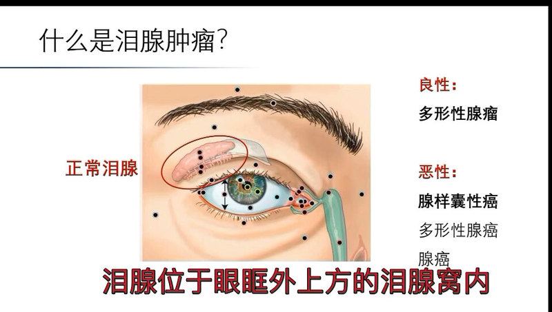 視頻封面