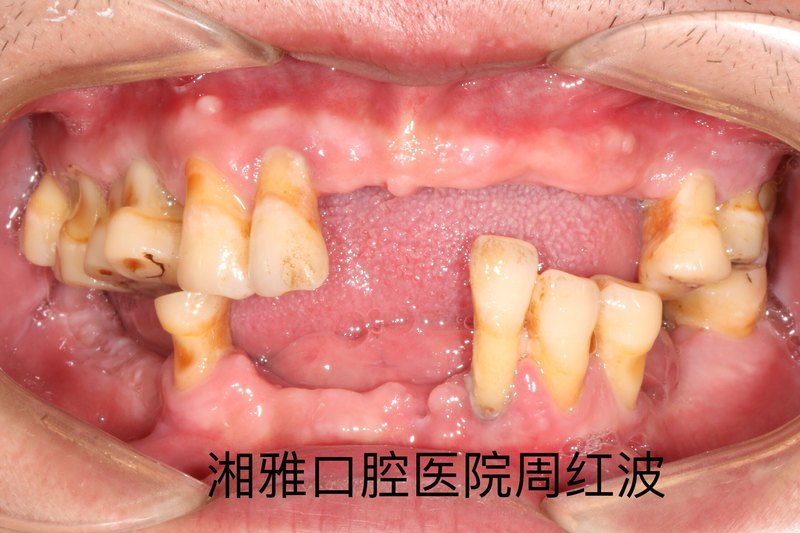 圖片