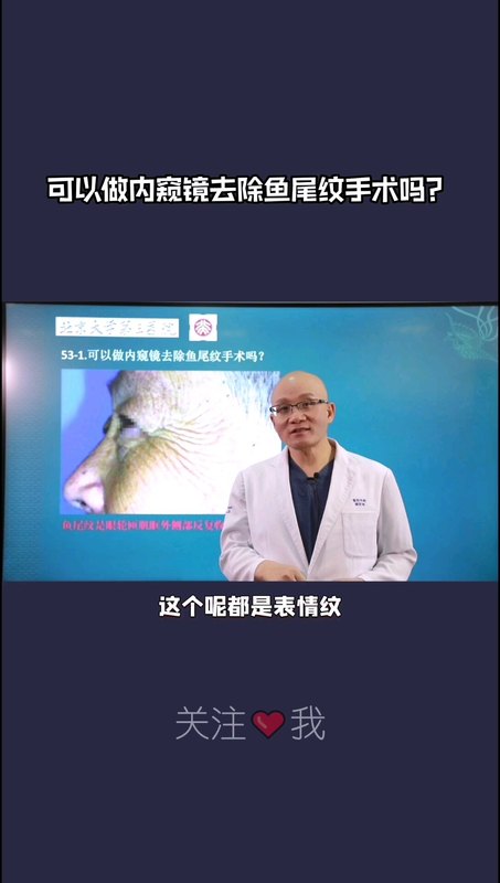 可以做内窥镜鱼尾纹去除手术吗？