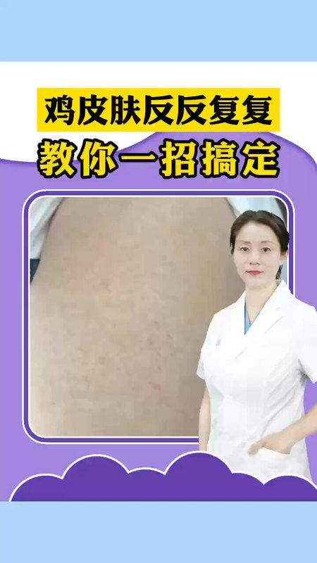 視頻封面