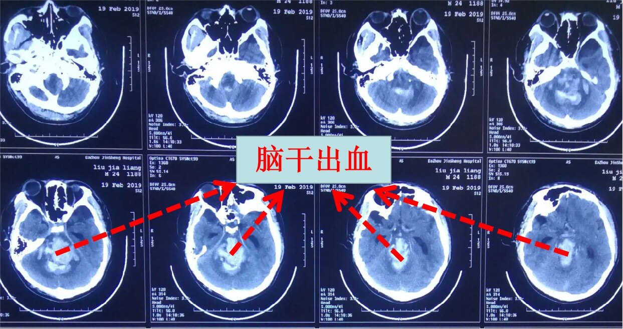 圖文圖片