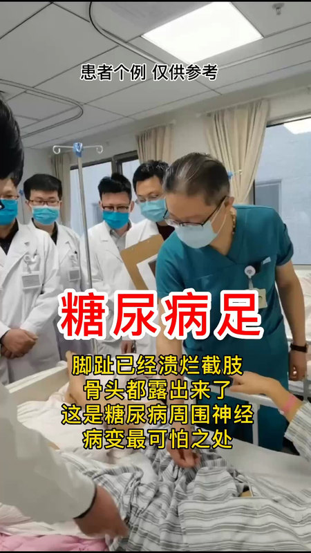 糖尿病足，脚趾溃烂截肢