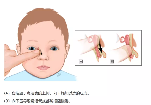 圖文圖片