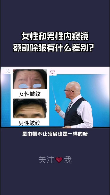 女性和男性内窥镜额部除皱有什么差别？