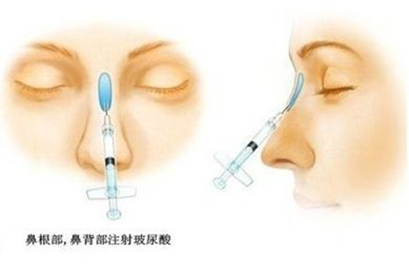 圖文圖片