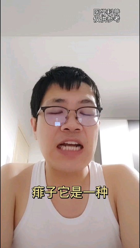 痱子的预防