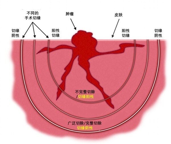 圖文圖片