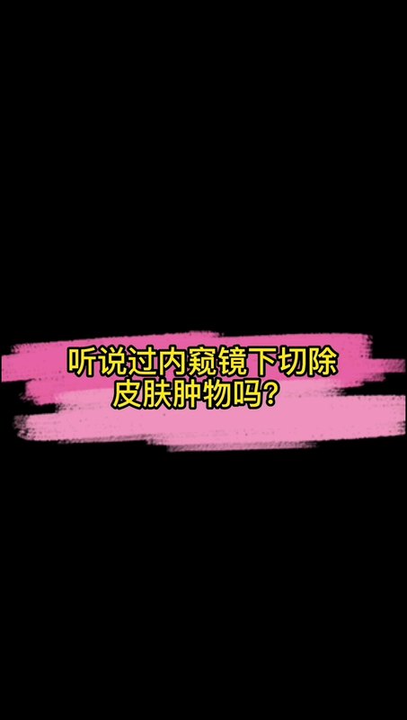 内窥镜皮肤肿物切除，微创小切口的手术，特别适合面部脂肪瘤