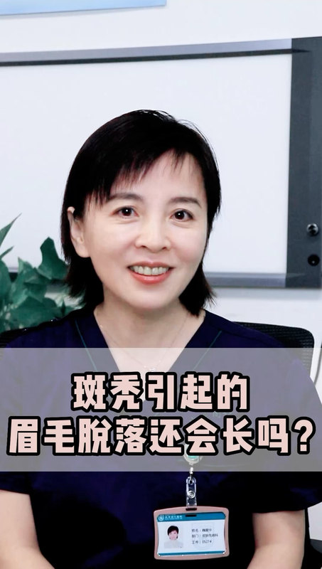 因为斑秃引起的眉毛脱落，还会长回来吗？