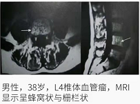 圖文圖片
