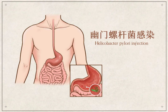 圖文圖片