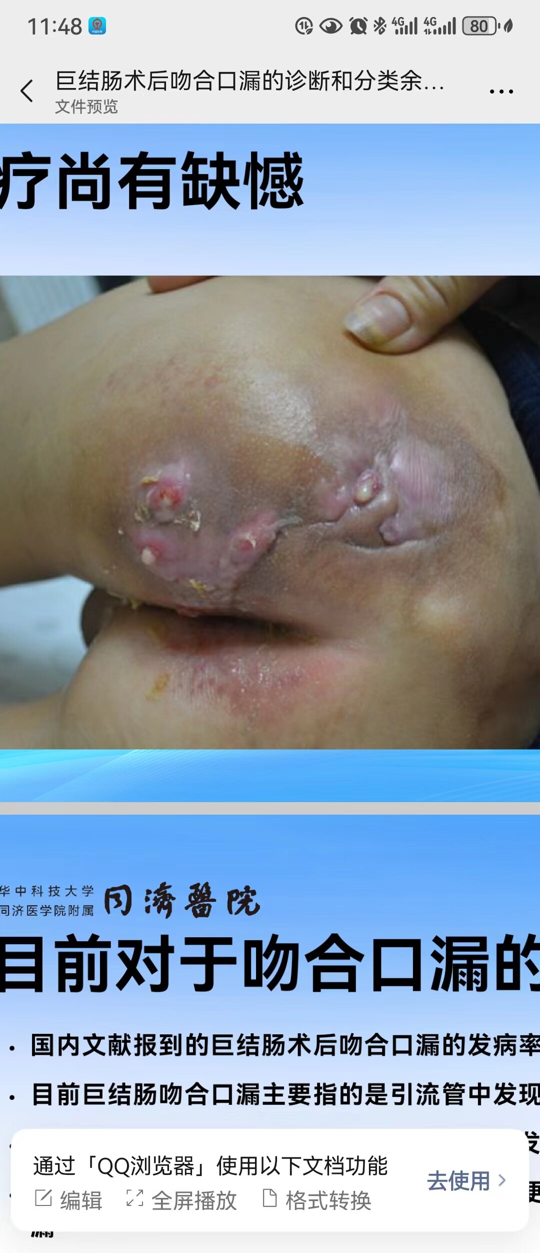 圖文圖片