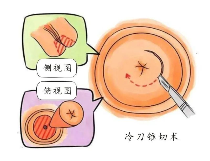 圖文圖片