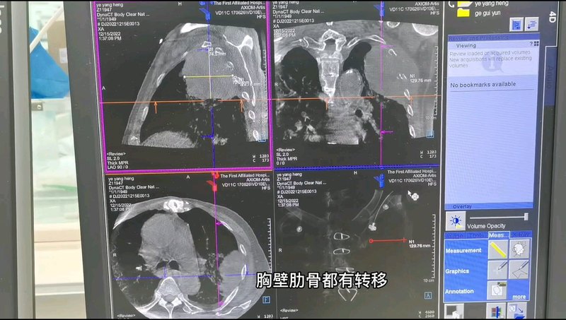 視頻封面