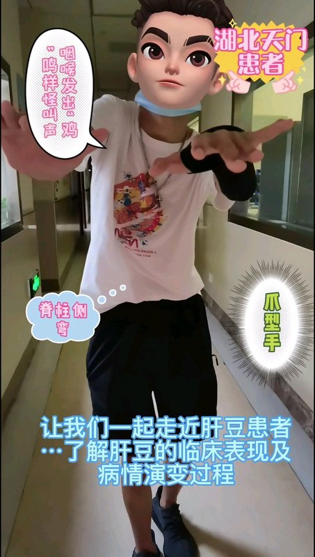 让我们一起走近肝豆患者…了解肝豆的临床表现及病情演变过程bb