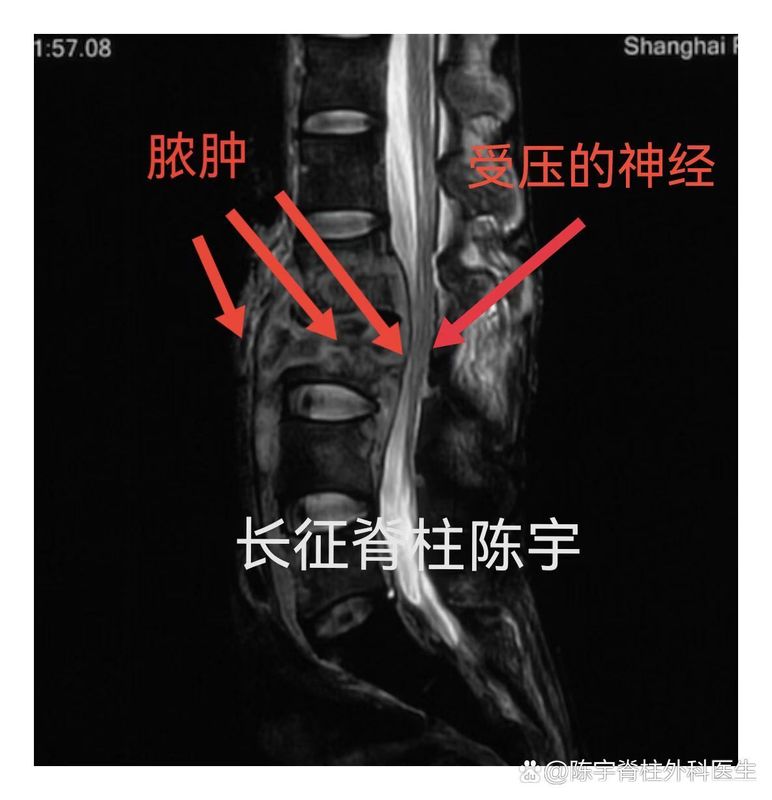 圖文圖片