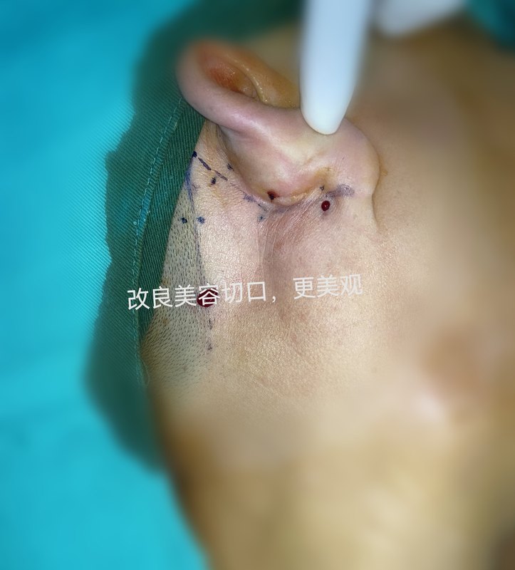 圖文圖片