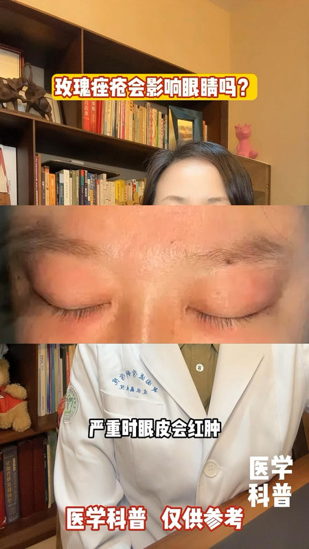 視頻封面