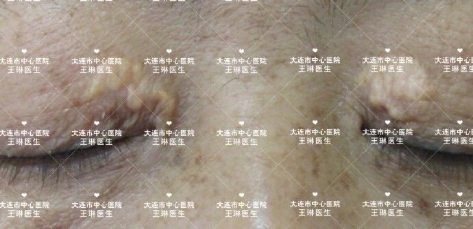 圖文圖片
