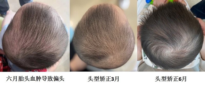 圖文圖片