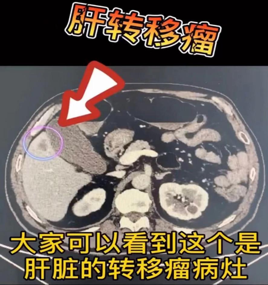 圖文圖片
