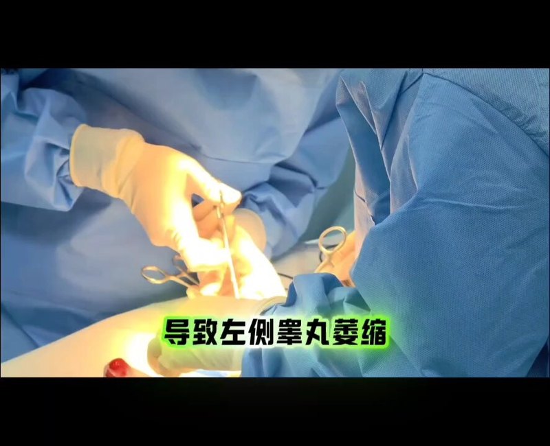 睾丸假体