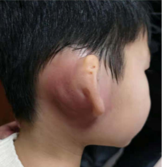 圖文圖片