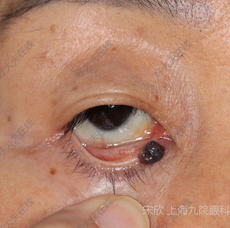圖文圖片