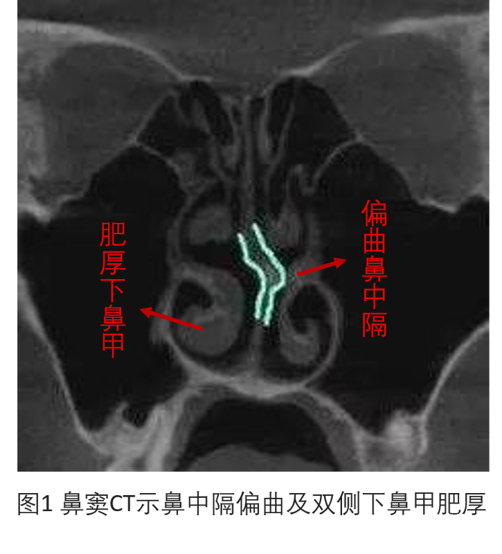 圖文圖片