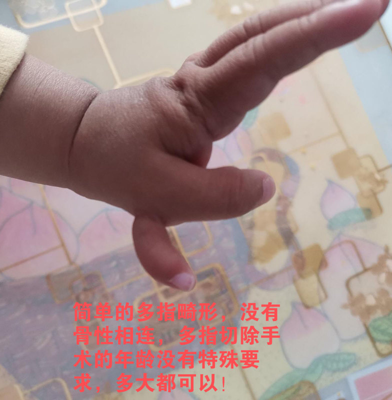 圖文圖片