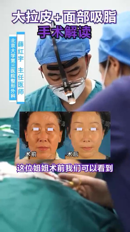 視頻封面