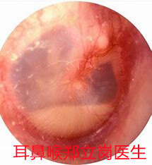 圖文圖片