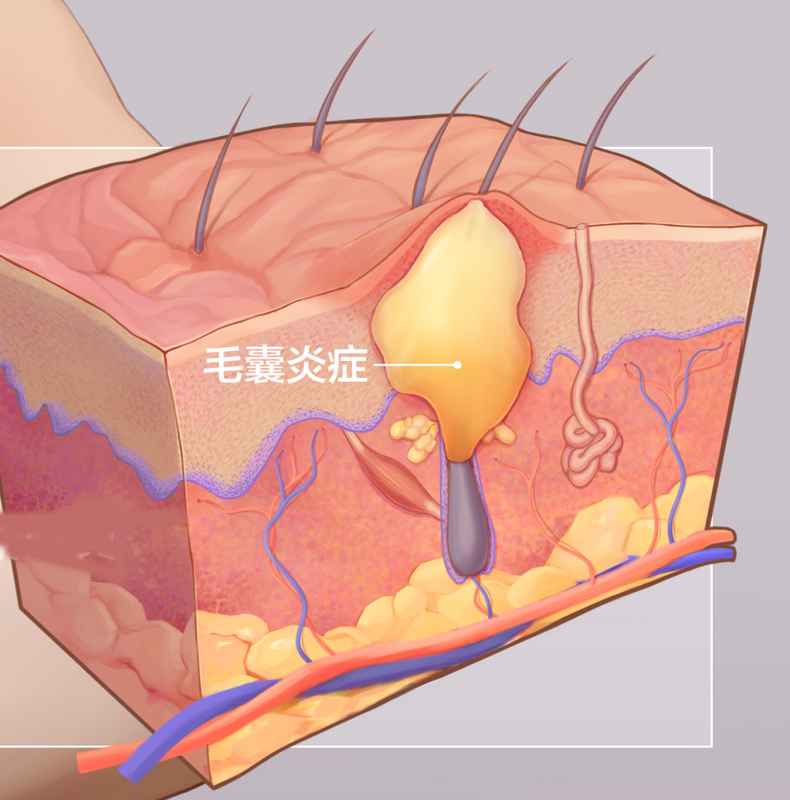 圖文圖片