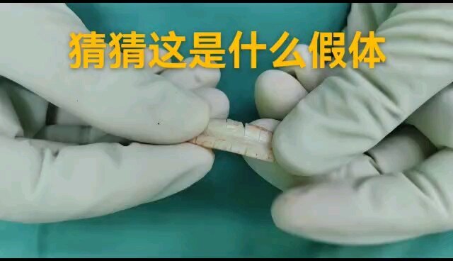 高仿真假体看看长什么样子，隆鼻的来看看吧