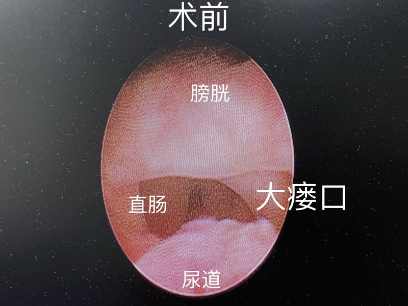 圖文圖片