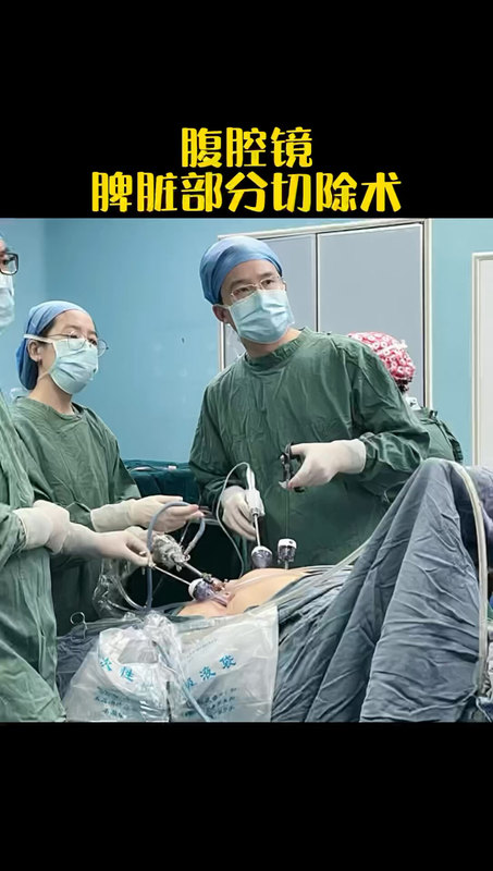 腹腔镜脾部分切除术