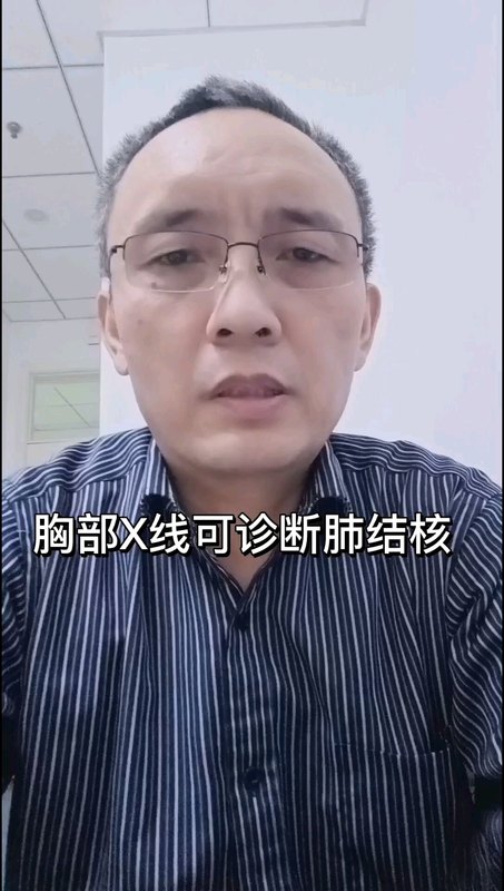 胸部X线可诊断肺结核