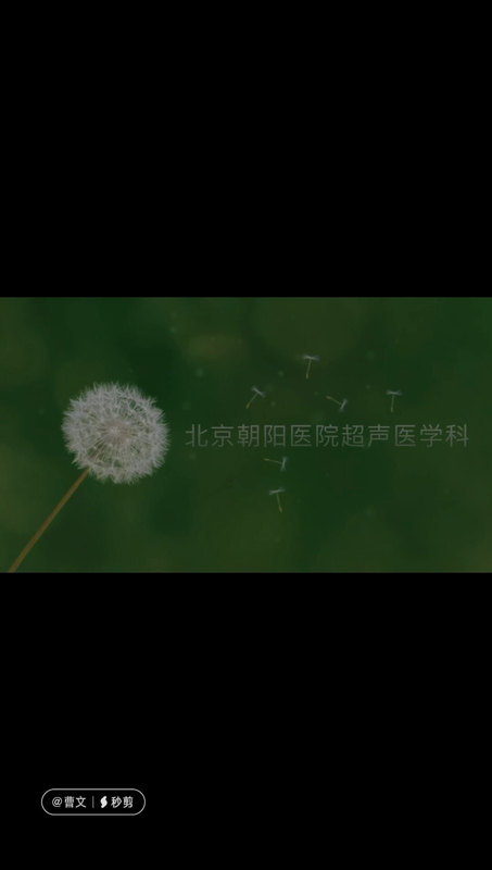 桡神经损伤超声引导下治疗术前术后评估