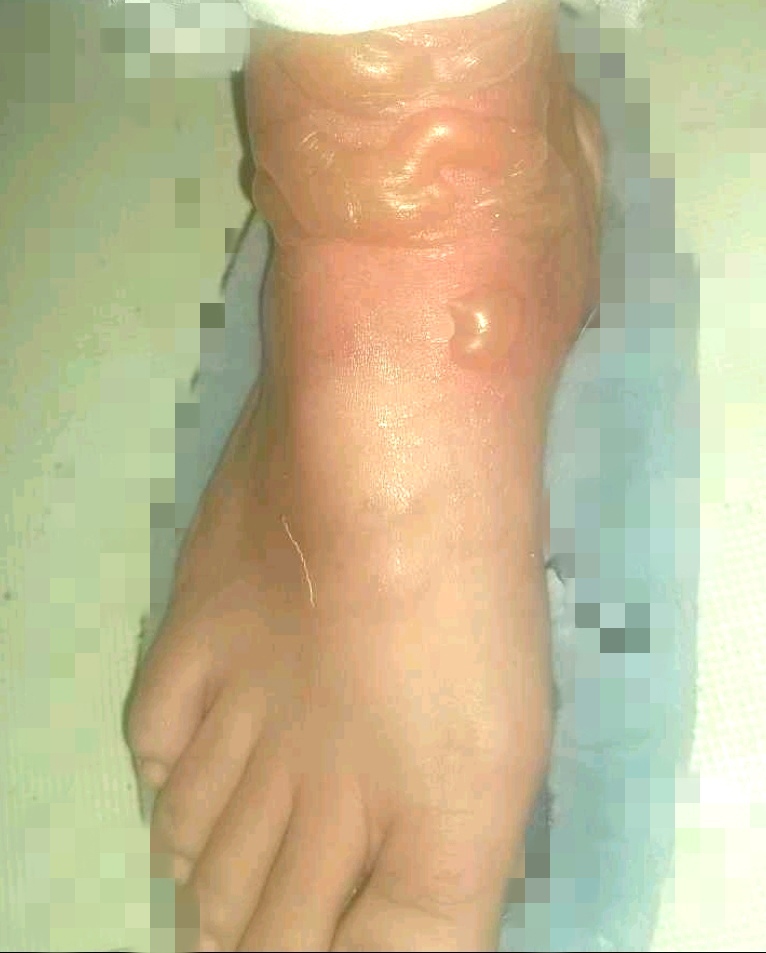 圖文圖片