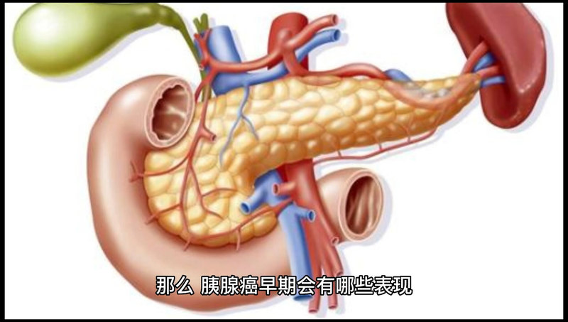 胰腺癌早期有哪些征兆？