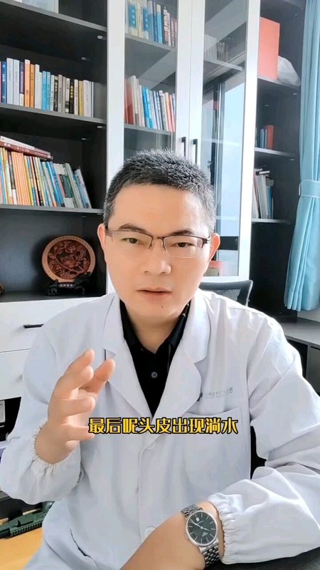头皮发红脱皮瘙痒怎么办？