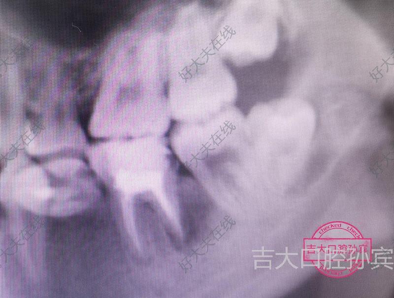 圖文圖片