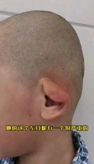 耷拉的耳朵是什么病？怎么治疗？