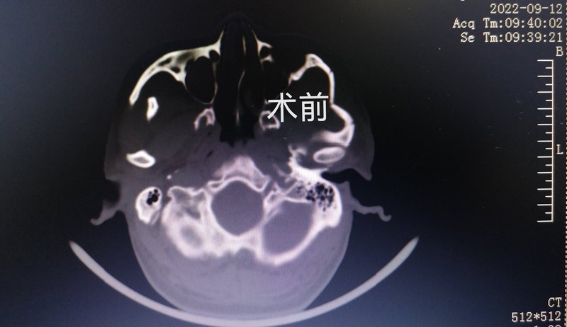 圖文圖片