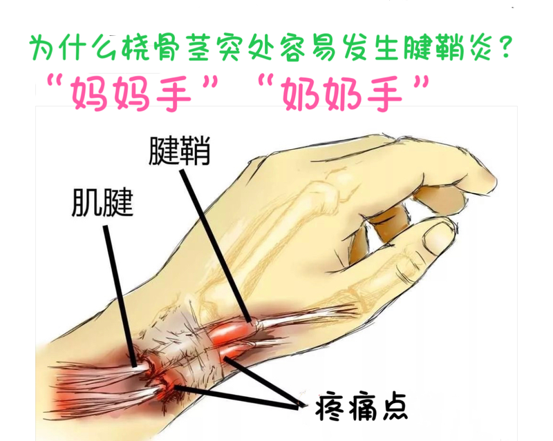 圖文圖片