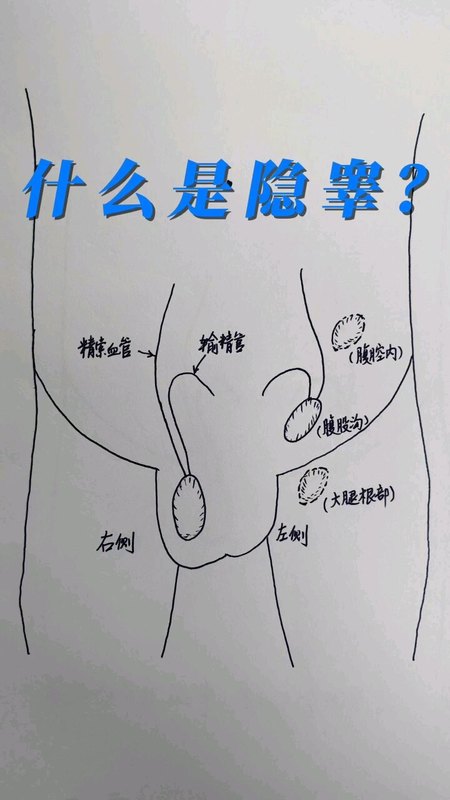 視頻封面