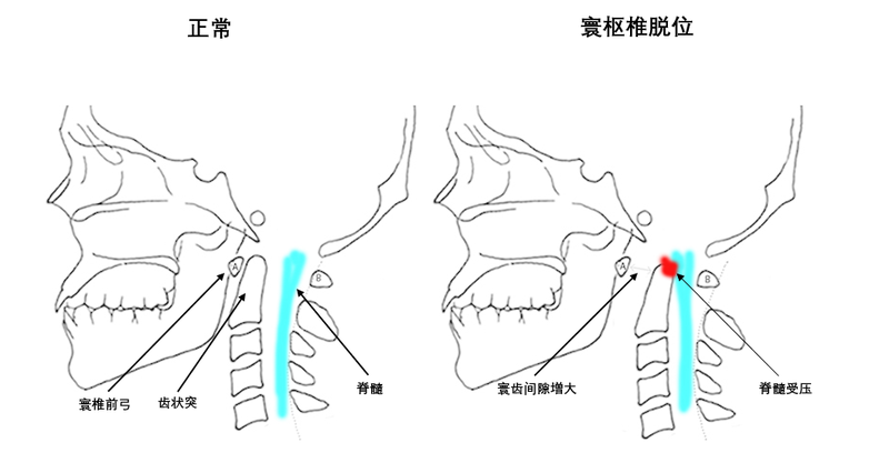 圖文圖片