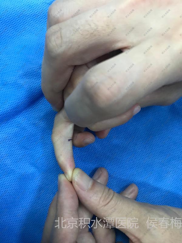 圖文圖片