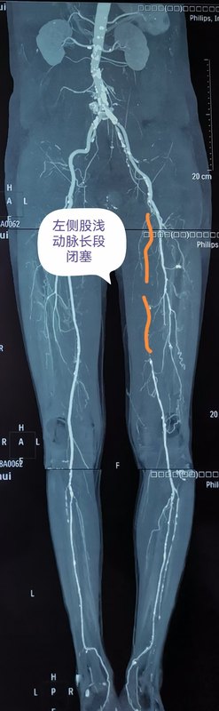 圖文圖片