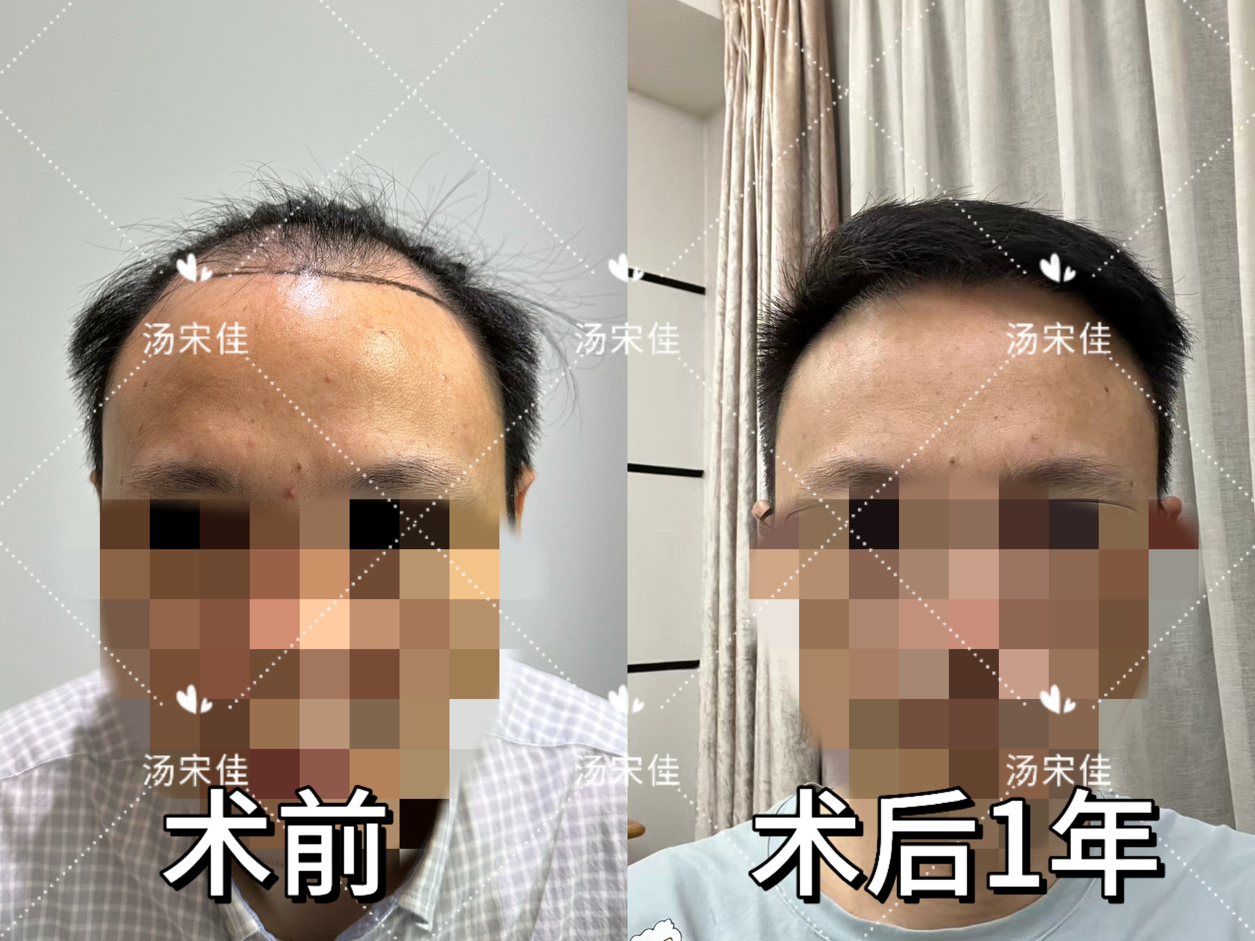 圖文圖片